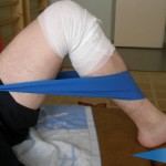 Възстановяване след артроскопия на менискуса: рехабилитация след операция на коляното след разкъсвания и наранявания