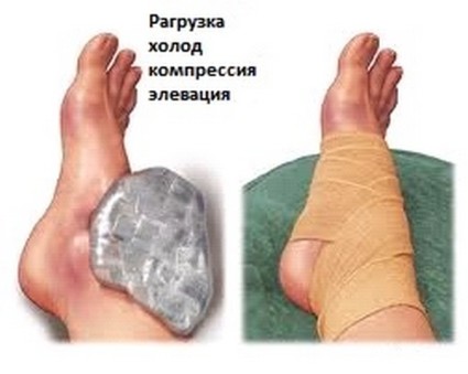 Самостоятелно лечение на наранявания на крака