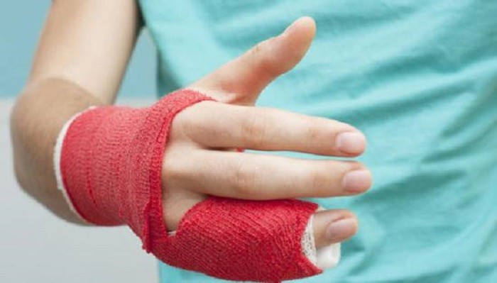 Признаци и лечение на фрактура на пръста