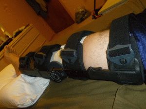 Навяхване на колянната връзка