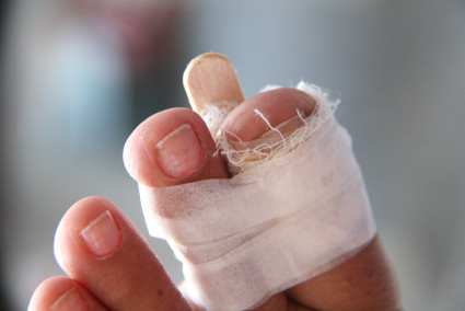 Симптомите на фрактура на големия пръст и методи на лечение