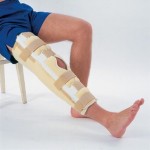 Разкъсване на коленния лигамент: симптоми и лечение на кръстосаните връзки на коляното