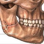 Челюстите стават болки: лечение на челюстта, причини за болка