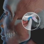 Челюстите стават болки: лечение на челюстта, причини за болка