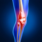 Коляното е подуто и боли при огъване: лечение на подути колене