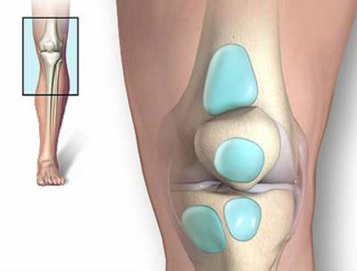 Как да се лекува костни колянна става?