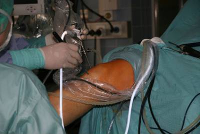 Хирургично лечение на заболявания на колянната става