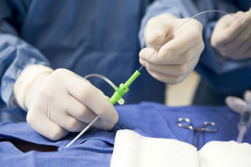 Хирургия за премахване на лумбалната интервертебрална херния