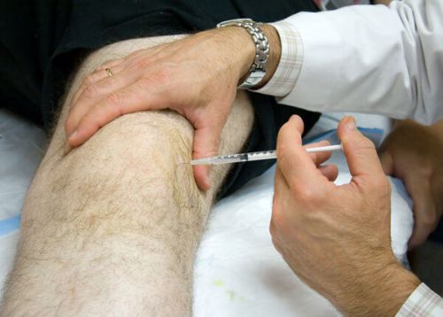 Инжекции в коляното с артроза на колянната става