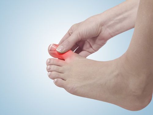 Лечение на солените отлагания в краката