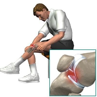 Какво представлява блокадата на колянната става