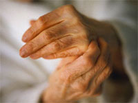 Как да се лекува артрит на ставите на пръстите?