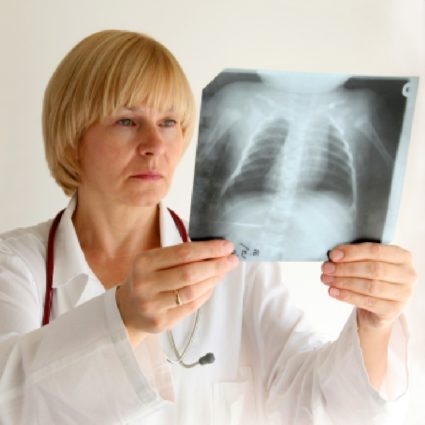 Лечение на туберкулоза на гръбначния стълб