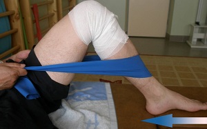 Развитие на колянната става по време на рехабилитация след травма или хирургия