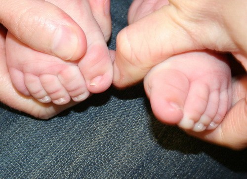Увит нокът в детето - как да се лекува