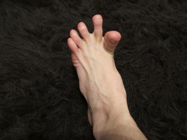 На краката на пръстите - причини