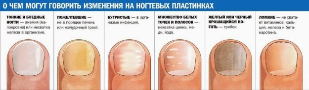 Деформация на ноктите по краката - причини и лечение