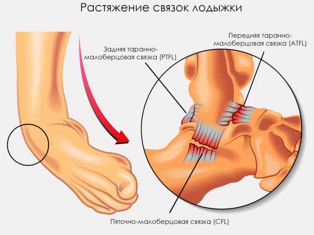 Кракът боли под пръстите при ходене