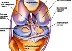 Лиганоза на колянната става