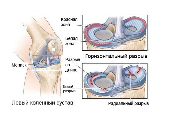 Симптомът на Байков - причини и лечение