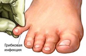 Средният пръст на крака боли