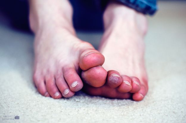 Син пръст на крака - причини и лечение