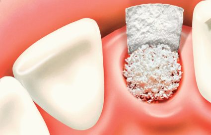 Болести, засягащи зъбите